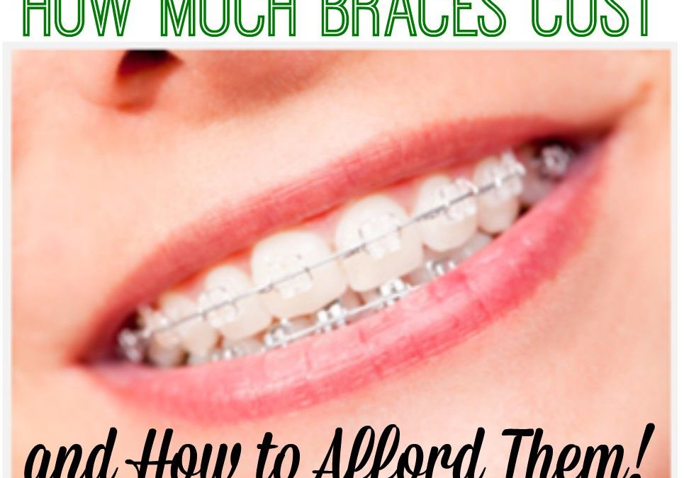 How Much Braces Cost and How To Afford Them